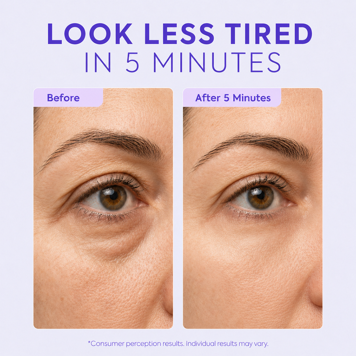 Instant Lift Eye Gel – Reduces the Look of Eye Bags
